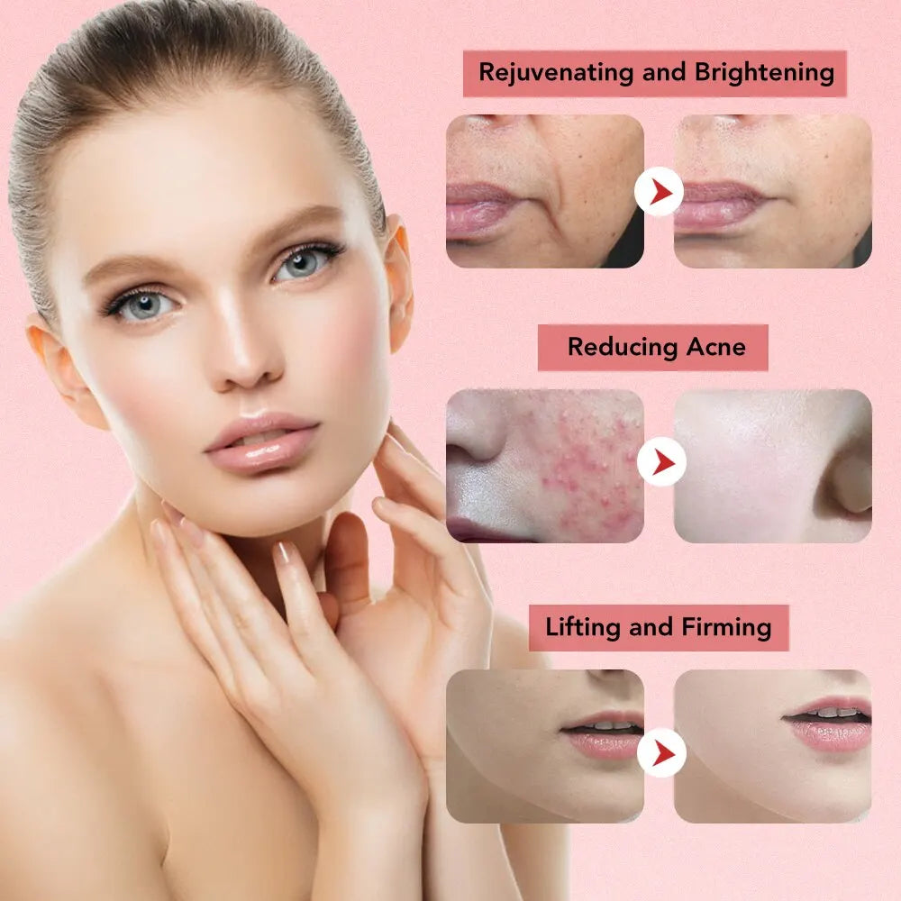 7-in-1 Microcurrent Face Lift Device